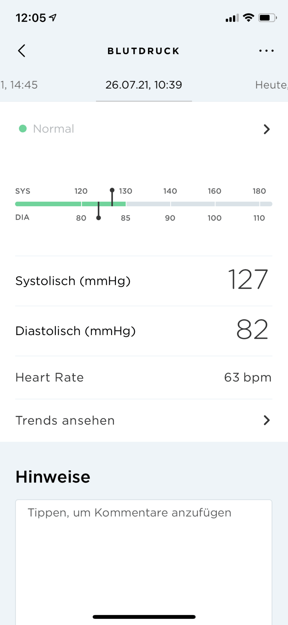 Apple Watch Blutdruck messen – So einfach geht&rsquo;s! - PCShow.de